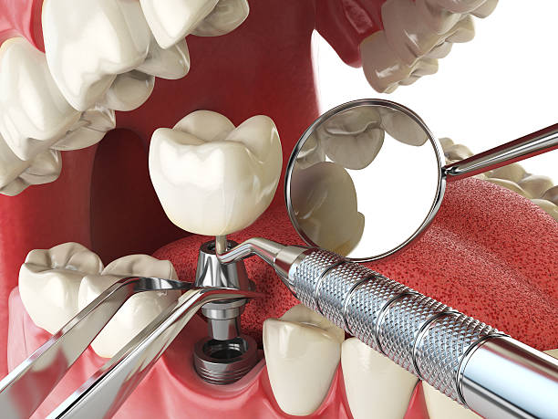 Best Broken or Cracked Tooth Emergency Dentist in Newberry, FL